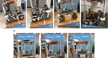You Won’t Believe What This Smart Walker Mobility Support Can Do!